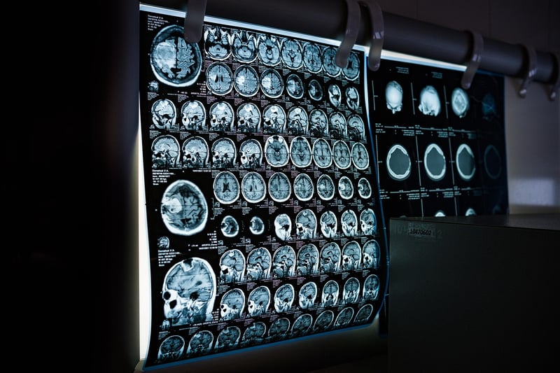 Body-Scan Meditation